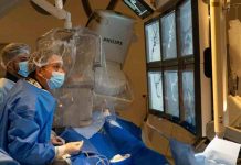 Unidad neurovascular innova en el tratamiento de aneurismas con dispositivo intrasacular