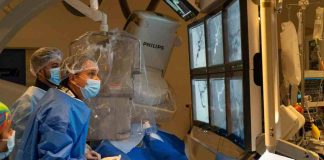 Unidad neurovascular innova en el tratamiento de aneurismas con dispositivo intrasacular