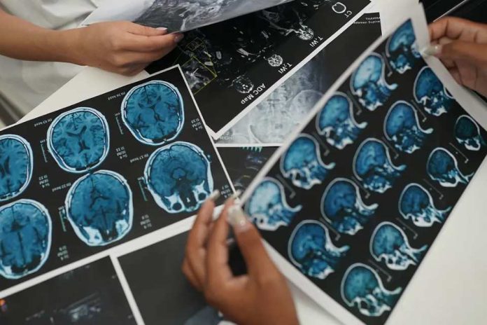 ACV en Chile La segunda causa de muerte y la primera discapacidad adquirida en adultos