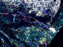 Australia Escudos y guardaespaldas los científicos descubren las defensas ocultas de un cáncer infantil mortal