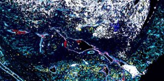 Australia Escudos y guardaespaldas los científicos descubren las defensas ocultas de un cáncer infantil mortal