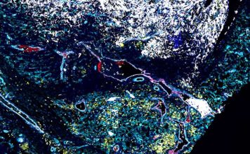 Australia Escudos y guardaespaldas los científicos descubren las defensas ocultas de un cáncer infantil mortal