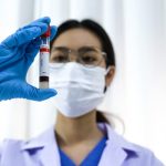 Sabemos más, pero nos cuidamos menos: la contradicción chilena tras el alza de las ITS