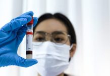 Sabemos más, pero nos cuidamos menos: la contradicción chilena tras el alza de las ITS