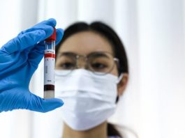 Sabemos más, pero nos cuidamos menos: la contradicción chilena tras el alza de las ITS