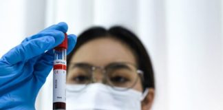 Sabemos más, pero nos cuidamos menos: la contradicción chilena tras el alza de las ITS