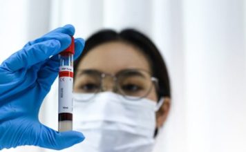 Sabemos más, pero nos cuidamos menos: la contradicción chilena tras el alza de las ITS