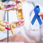 Hasta el 90% del cáncer colorrectal puede curarse con detección temprana