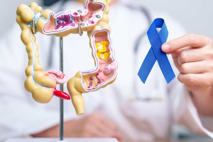 Hasta el 90% del cáncer colorrectal puede curarse con detección temprana