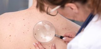 Operativo gratuito de chequeo de lunares en Reñaca supera su meta y realiza más de 1.500 revisiones dermatológicas