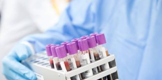 Primer caso de ‘curación’ del VIH con un trasplante de células madre procedente de un hermano