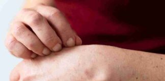Alerta sanitaria por sarampión: ¿Quiénes deben vacunarse? Alerta sanitaria por sarampión: ¿Quiénes deben vacunarse?