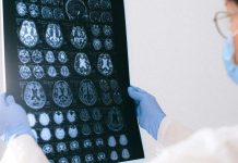 Año del cerebro en Chile: Académica detalla sus funciones y principales patologías