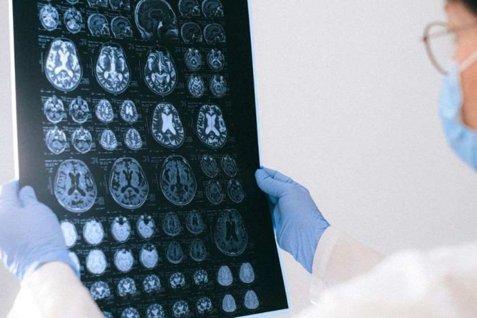 Año del cerebro en Chile Académica detalla sus funciones y principales patologías Año del cerebro en Chile: Académica detalla sus funciones y principales patologías