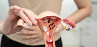 Cáncer de ovario: 7 de cada 10 casos se detectan tarde