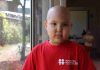 Chile lidera la sobrevida del cáncer infantil, pero sigue rezagado respecto a la OCDE