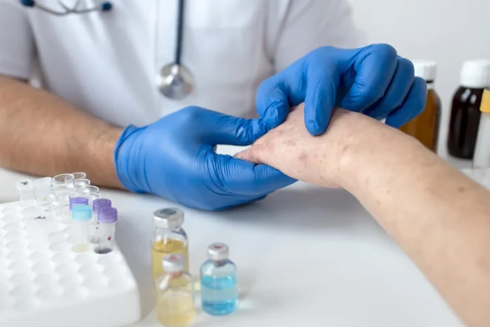 Lupus-1536x1024 Lupus: la enfermedad que lleva al sistema inmune a atacar el propio organismo