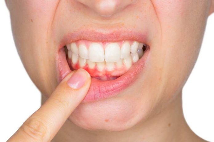 Sangrado de encías no es normal: especialista alerta sobre grave crisis de salud periodontal en Chile