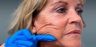Medicina estética después de las redes sociales: el desafío de cuidar al paciente, clinica medicina estética