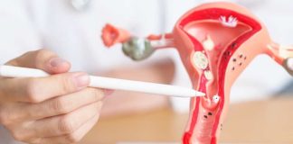 Endometriosis 5 síntomas que no deberías normalizar y los riesgos de no detectarla a tiempo