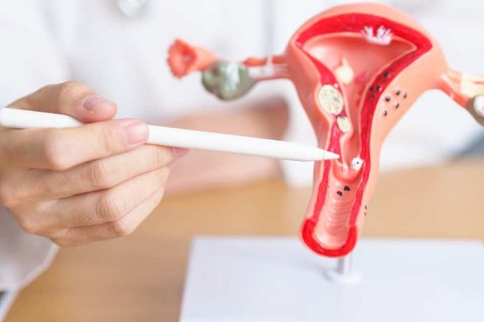 Endometriosis 5 síntomas que no deberías normalizar y los riesgos de no detectarla a tiempo