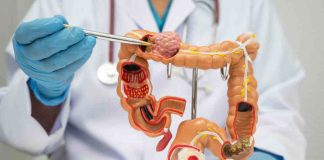 Santiago reunirá a expertos nacionales e internacionales en oncología colorrectal