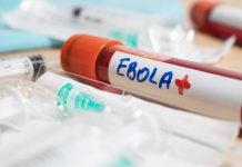 El brote de ébola más letal en la historia del Congo: qué lo hace distinto y por qué el riesgo para Chile es bajo El brote de ébola más letal en la historia del Congo: qué lo hace distinto y por qué el riesgo para Chile es bajo