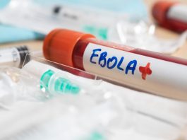 El brote de ébola más letal en la historia del Congo: qué lo hace distinto y por qué el riesgo para Chile es bajo