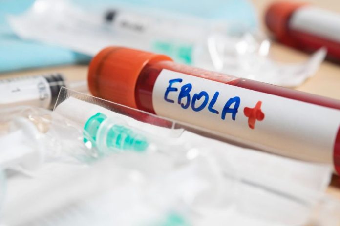 El brote de ébola más letal en la historia del Congo: qué lo hace distinto y por qué el riesgo para Chile es bajo