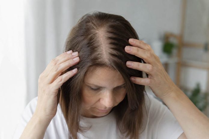 La edad no siempre explica la pérdida de cabello:  Qué señales deberían alertar a las mujeres después de los 50