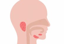 Las señales de alerta para reconocer a tiempo un cáncer de cabeza y cuello Las señales de alerta para reconocer a tiempo un cáncer de cabeza y cuello