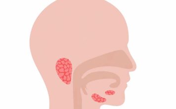 Las señales de alerta para reconocer a tiempo un cáncer de cabeza y cuello