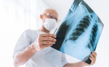 Qué debemos saber sobre la tuberculosis Qué debemos saber sobre la tuberculosis