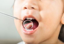 Radiografía a la salud buco dental de las niñas y niños en Chile
