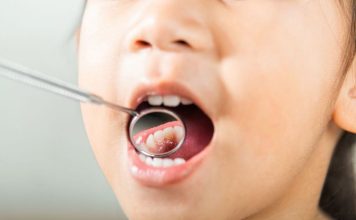 Radiografía a la salud buco dental de las niñas y niños en Chile Radiografía a la salud buco dental de las niñas y niños en Chile