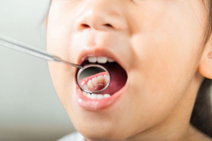 Radiografía a la salud buco dental de las niñas y niños en Chile