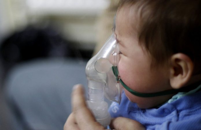Virus sincicial lidera circulación viral en Chile: cómo reconocer a tiempo los cuadros de mayor riesgo en menores de dos años