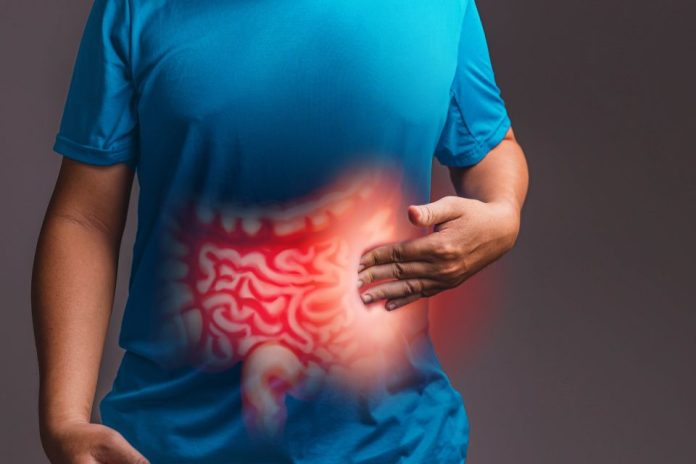 Cáncer colorrectal al alza en Chile: el test FIT ayuda a detectarlo a tiempo y los estudios genéticos a tratarlo mejor