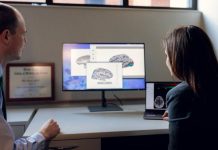 Columna de opinión | Un estudio de Mayo Clinic identifica nuevas dianas cerebrales para el tratamiento personalizado de la epilepsia