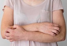 Día Mundial de la Dermatitis Atópica: 8 de cada 10 casos en mujeres aparecen por primera vez durante el embarazo