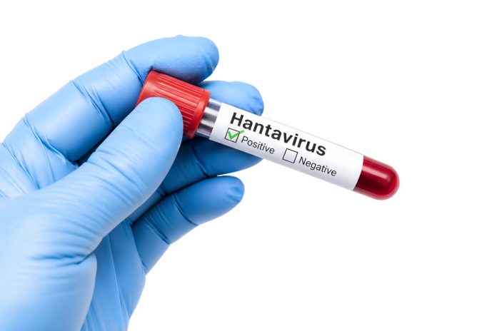 El aumento de casos de hantavirus bajo la lupa de la investigación chilena El aumento de casos de hantavirus bajo la lupa de la investigación chilena