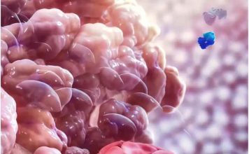 Internacional | Descubren cómo el cáncer puede resistir la inmunoterapia