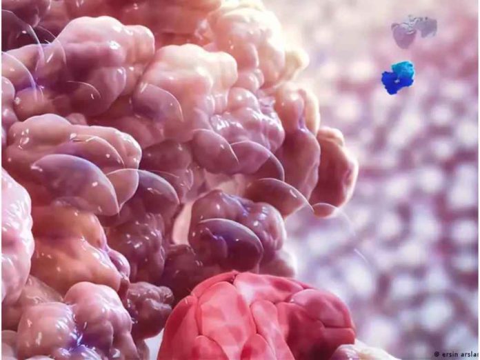 Internacional Descubren cómo el cáncer puede resistir la inmunoterapia Internacional | Descubren cómo el cáncer puede resistir la inmunoterapia