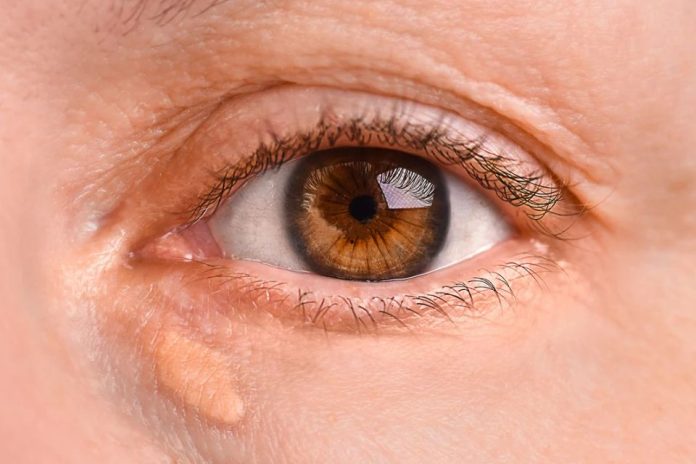 Internacional | La señal de advertencia de infarto e ictus que puede aparecer en el rostro