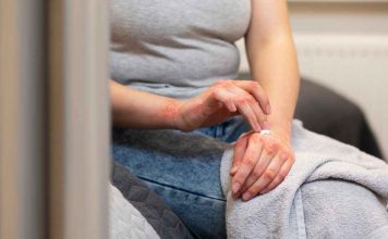 ¿Qué es la sífilis?: Preocupa el aumento en tasa de contagio en personas mayores