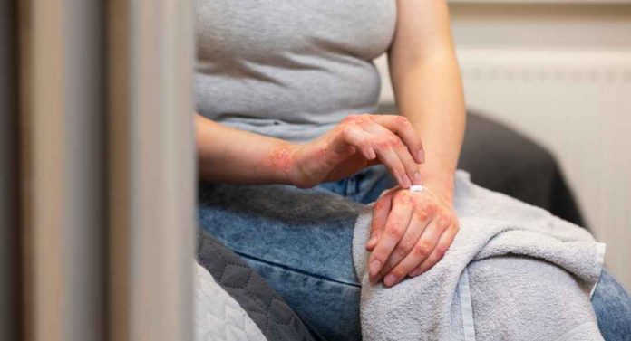 ¿Qué es la sífilis?: Preocupa el aumento en tasa de contagio en personas mayores