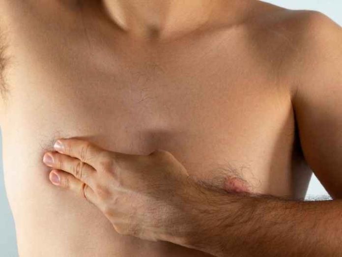 Cáncer de mama en hombres: cómo reconocer sus síntomas y qué factores aumentan el riesgo de padecerlo