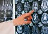 Día Mundial del ACV: cada minuto sin tratamiento se pierden dos millones de neuronas