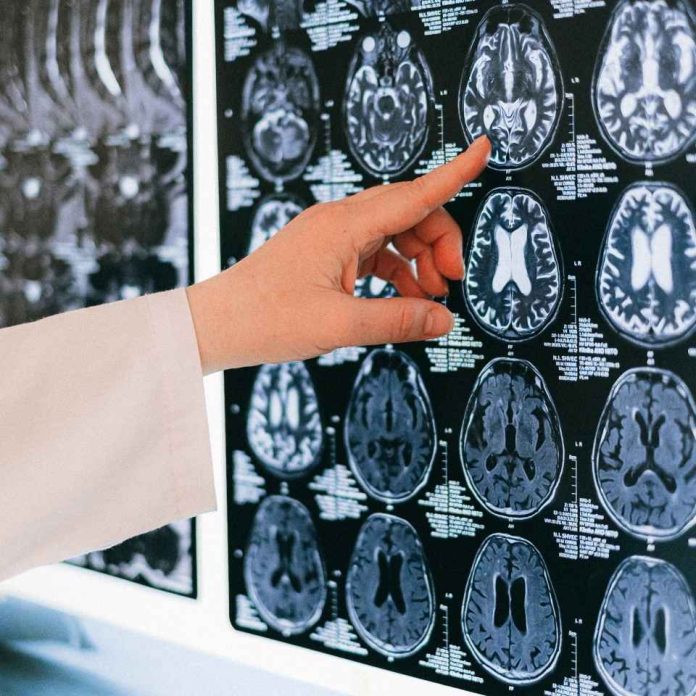 Día Mundial del ACV: cada minuto sin tratamiento se pierden dos millones de neuronas