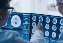 No todo bulto es cáncer: cómo diferenciar un nódulo, un quiste y un tumor No todo bulto es cáncer: cómo diferenciar un nódulo, un quiste y un tumor